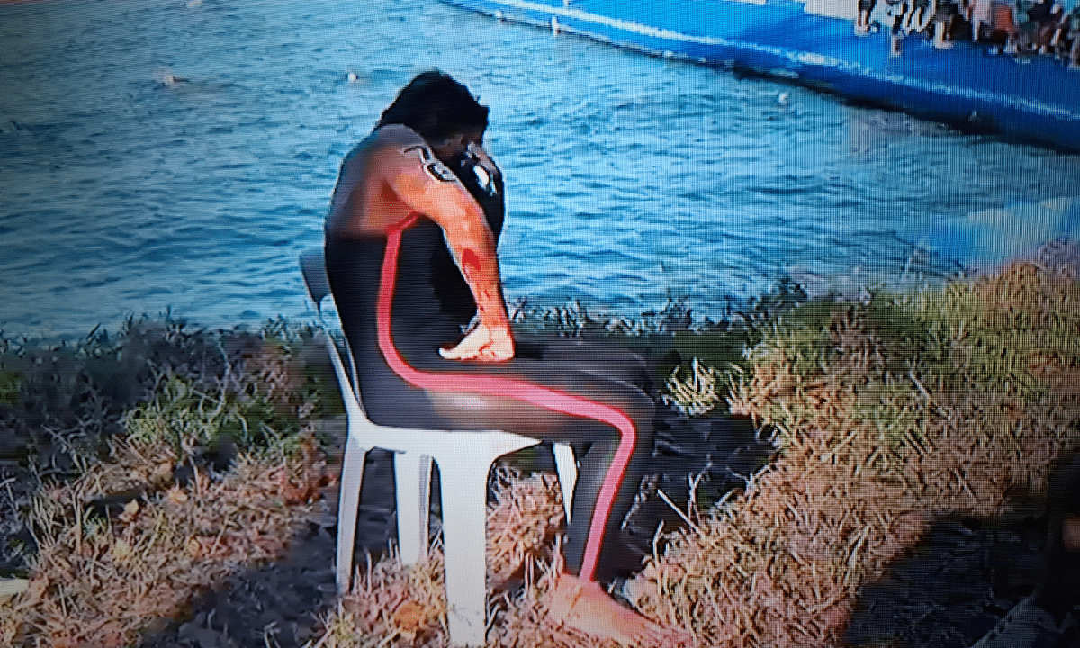 Ana Marcela Cunha com corte no braço após prova do MUNDIAL DE ESPORTES AQUÁTICOS