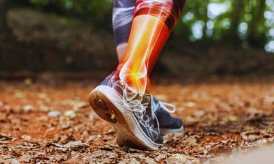 Como fortalecer tornozelos para corrida, futebol, vôlei e basquete