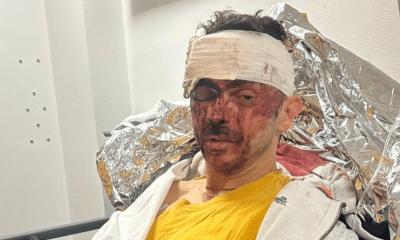 Cavaleiro medalhista paralímpico é atropelado por moto na França